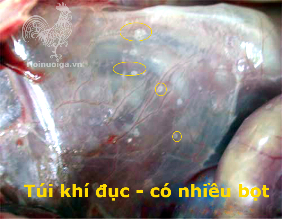 benh-crd-o-ga-cach-dieu-tri