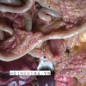 Bệnh Lơ Cô ( Ung thư Leucosis )