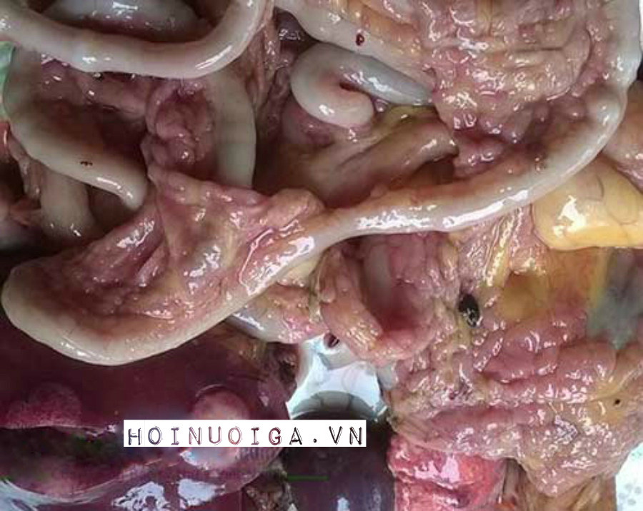 Bệnh Lơ Cô ( Ung thư Leucosis )