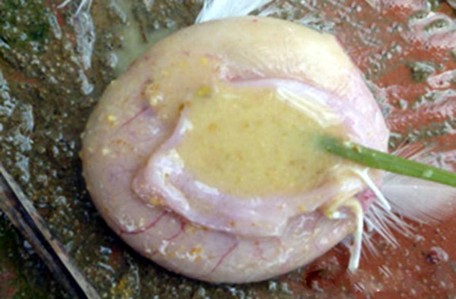 benh-nam-dieu-duong-tieu-hoa-o-ga