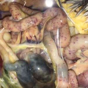 Bệnh Viêm ruột hoại tử