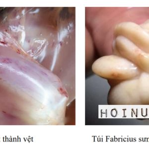 Bệnh Gumboro trên Gà