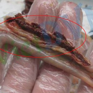 Bệnh Cầu Trùng ở Gà