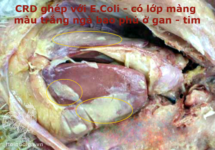 ga-bi-benh-crd-ghep-ecoli