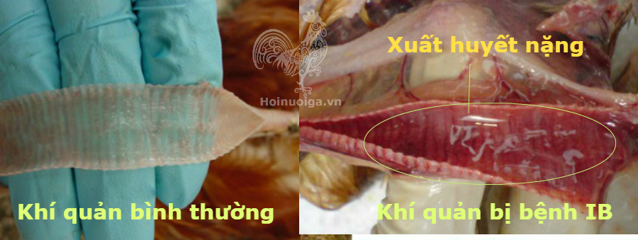 ga-bi-benh-ib-2 viên phế quản truyền nhiễm, bệnh ib