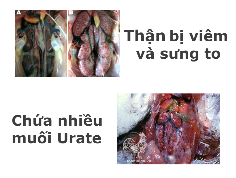 ga-bi-benh-ib-viem-phe-quan-2