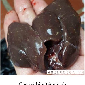 Bệnh Lơ Cô ( Ung thư Leucosis )