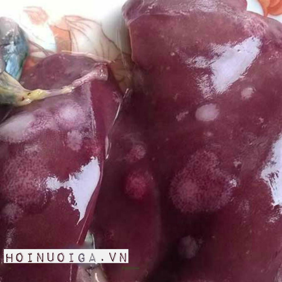 Bệnh Lơ Cô ( Ung thư Leucosis )