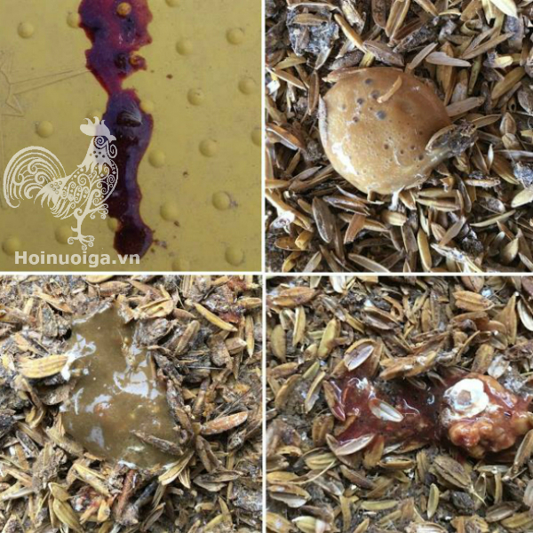 phan-ga-bi-nhu-the-nay-la-benh-gi-ga-bi-cau-trung