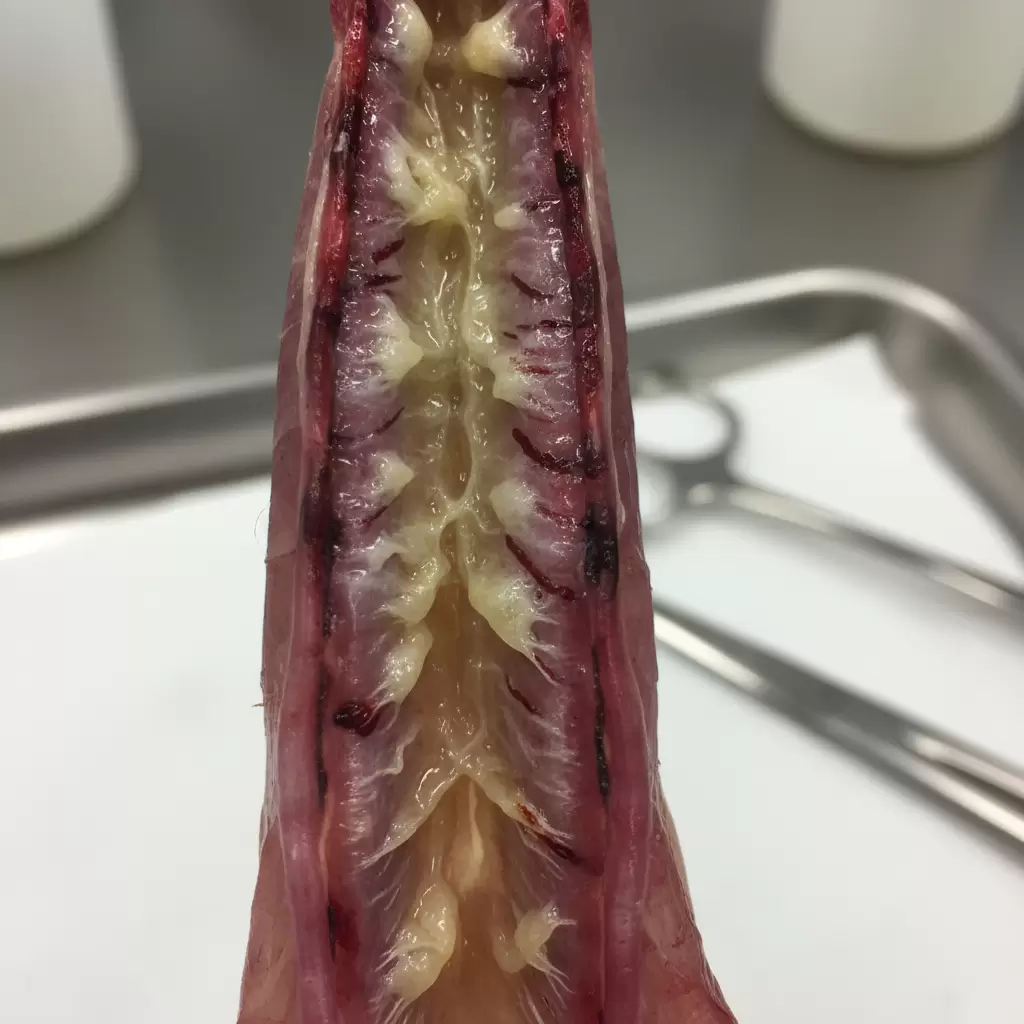 gemini_image_1770083568 Tổn thương niêm mạc khí quản với dịch nhầy đặc trưng của bệnh viêm phế quản truyền nhiễm